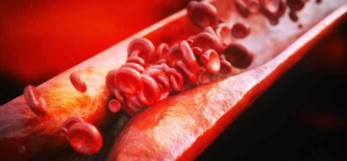 Атеросклероз сосудов головного мозга