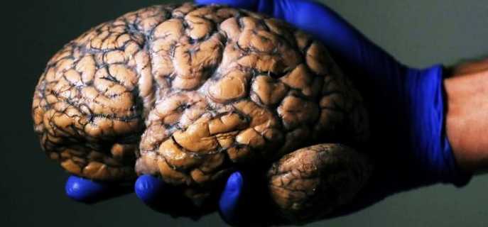 Строение головного мозга человека