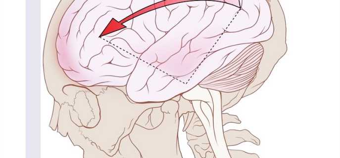 Виды, диагностика и лечение травм головы