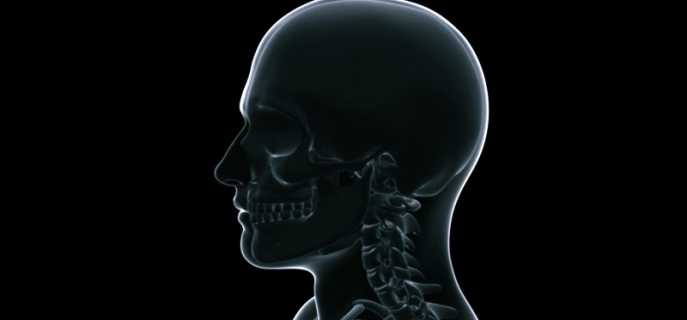 Противопоказания, показания и особенности рентгена головы