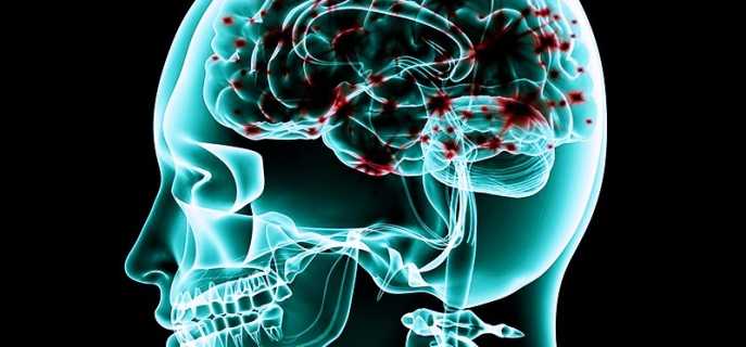 Причины ишемических атак, их симптомы и лечение