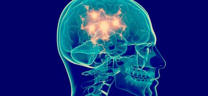 Причины, диагностика и лечение болезни Паркинсона