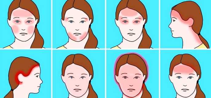 Основные виды головной боли