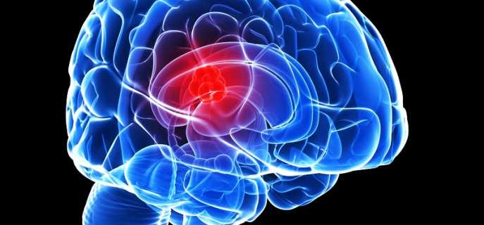 Сколько можно прожить с опухолью головного мозга