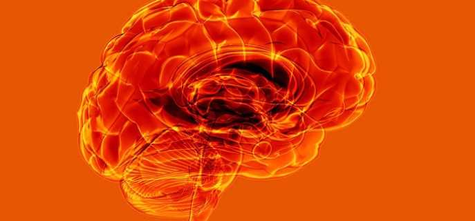 Причины и профилактика инсульта