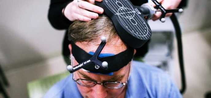 Транскраниальная магнитная стимуляция мозга