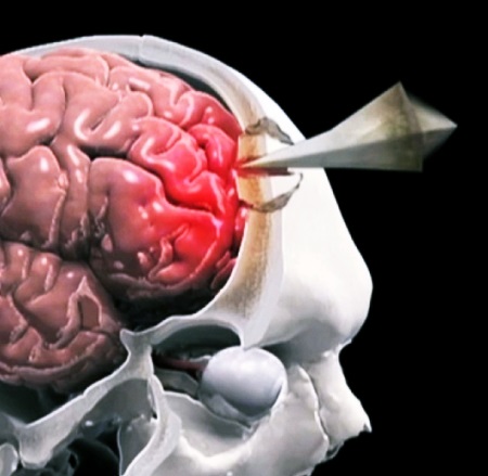 Повреждение