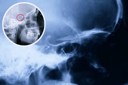 Локализация