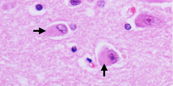 Абстракция