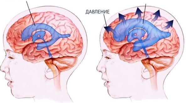 Как возникает