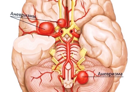 Места дислокации
