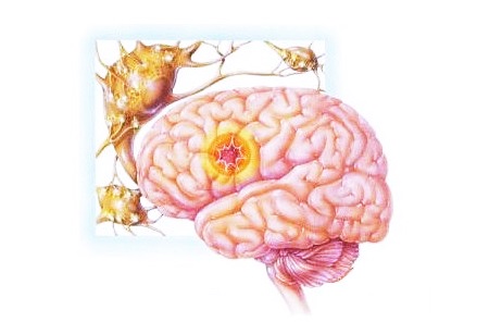 Место возникновения