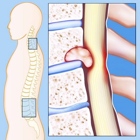 Позвоночник