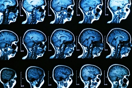 Томограммы