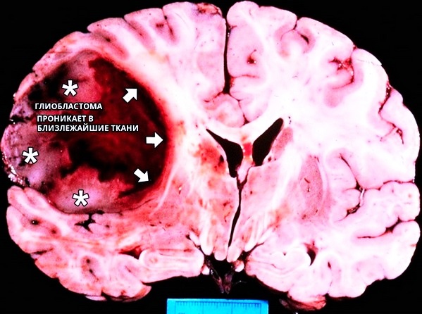 Разрастание