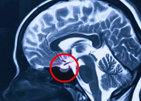 Локализация