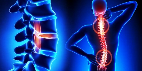 Позвоночник