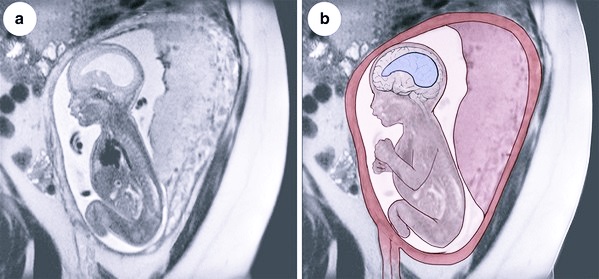 Сканирование