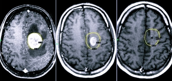 Место дислокации