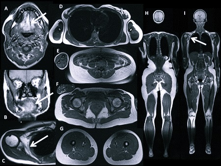 Томограммы