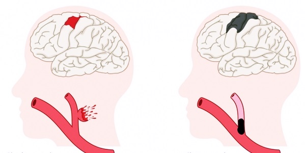 Разновидности