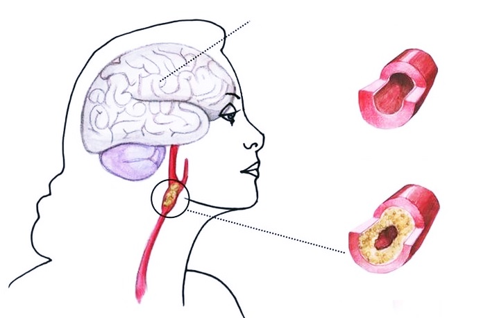 Здоровый и больной