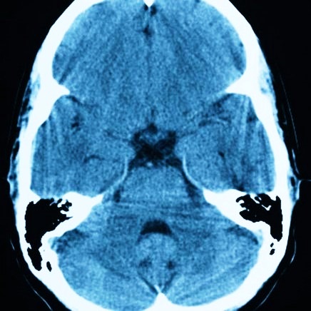 Томограмма