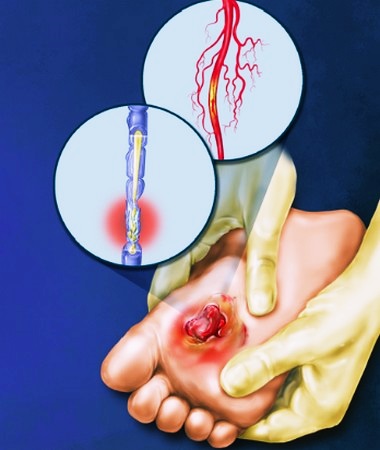 Как возникает