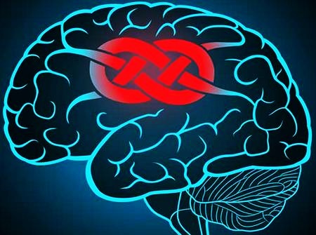 Локализация