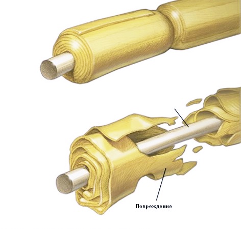 Повреждения