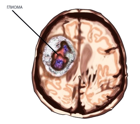 Расположение