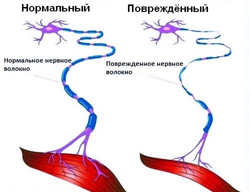 Как выглядит