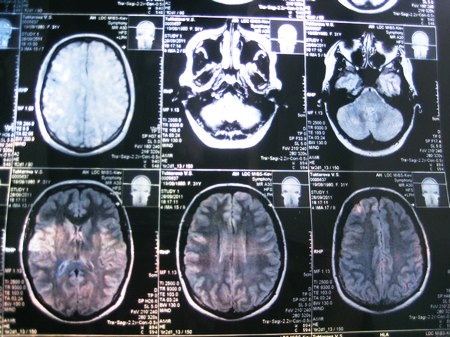 Томограмма