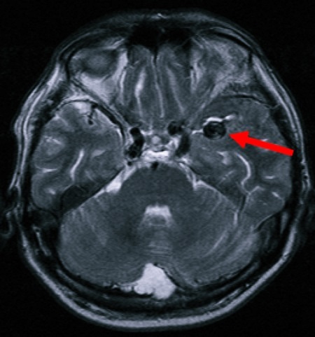Томограмма