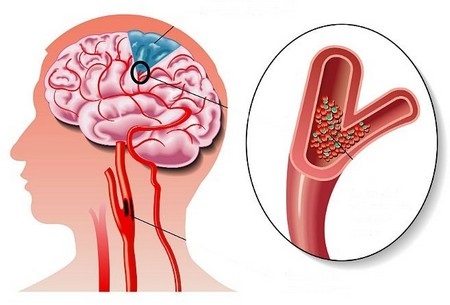 Формирование