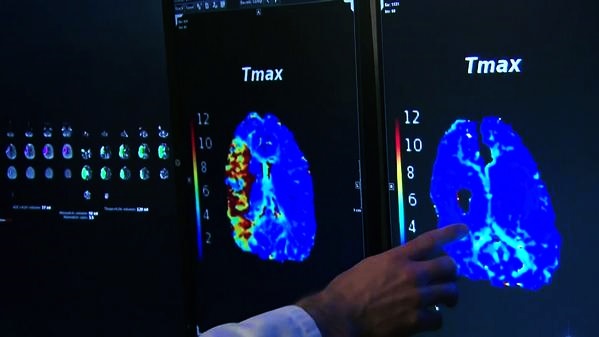 Томограммы