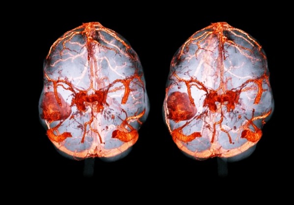 Визуализация