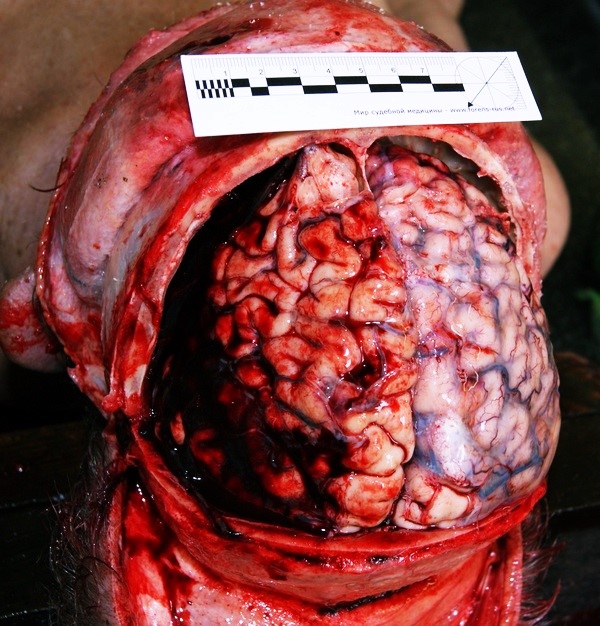 Внешний вид