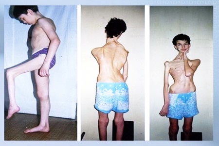 Последствия