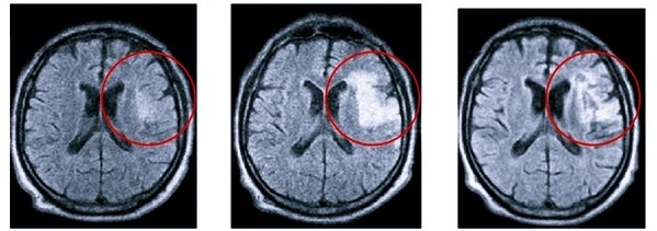 Локализация