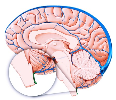 Увеличение