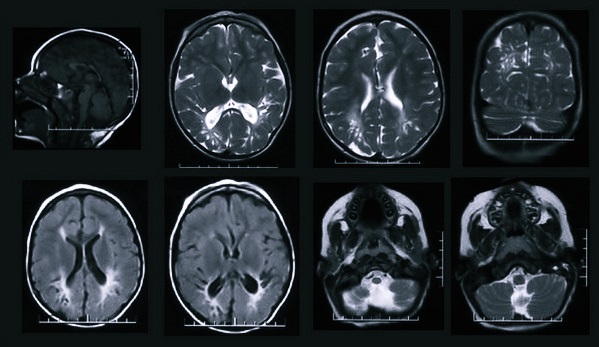 Снимки головы