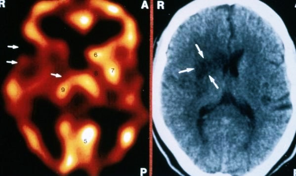 Локализация