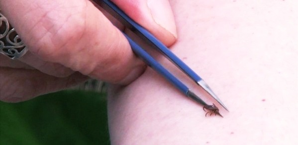 Извлечение