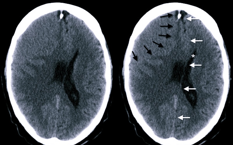 Сравнение травм