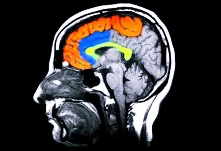 Под черепной коробкой