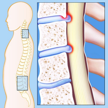 Позвоночник