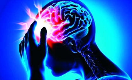 Головная боль