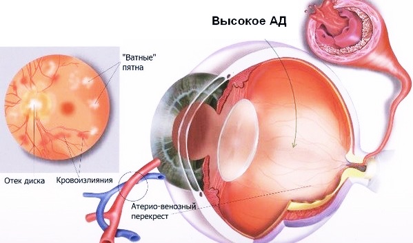 Возникновение
