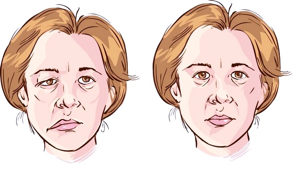 Лицо нормального человека и больного